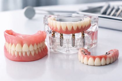 alternative alla dentiera